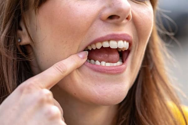 עקירת שן טוחנת