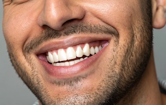 השתלת שיניים בהתאמה אישית