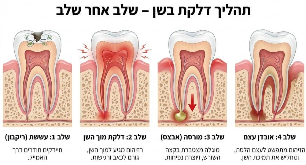 תהליך דלקת בשן - שלב אחר שלב